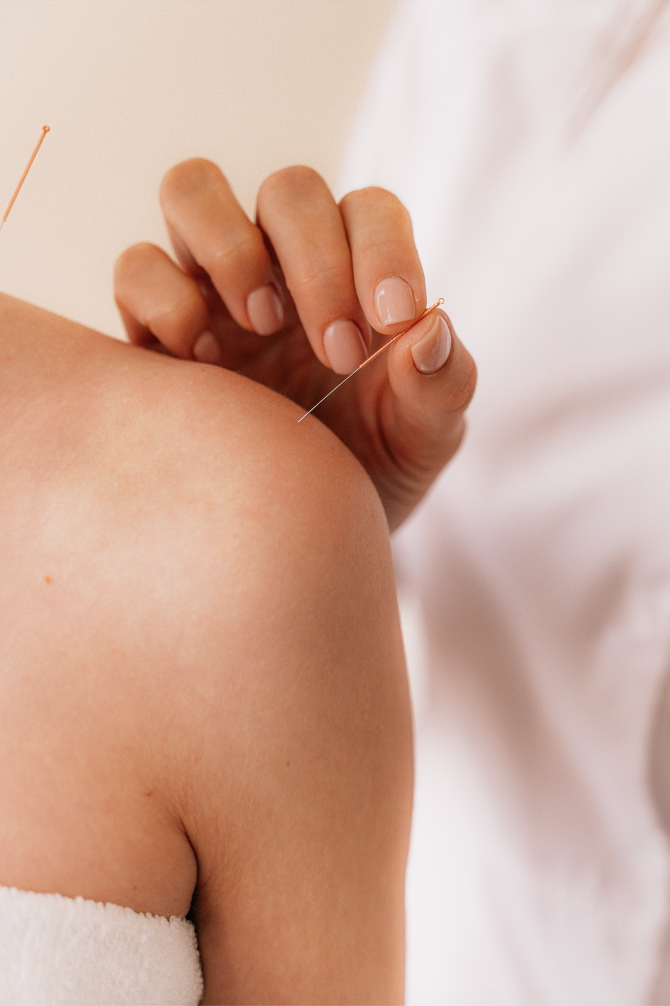 Acupuntura para la menopausia | Síntomas de la Menopausia | Womanhood
